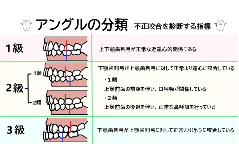 アングルの分類